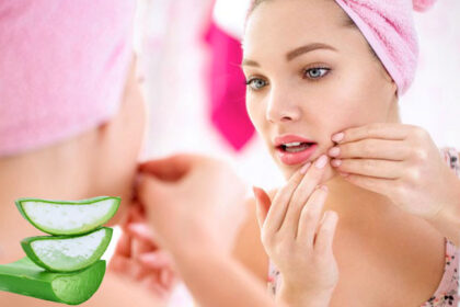 Acne e Aloe Vera
