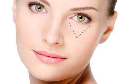 Nascondere occhiaie con il make up