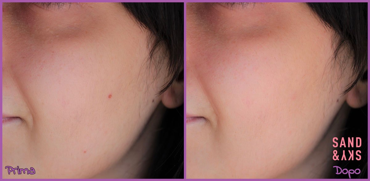 Prima e dopo l'utilizzo della Maschera viso all'argilla Rosa Sand & Sky