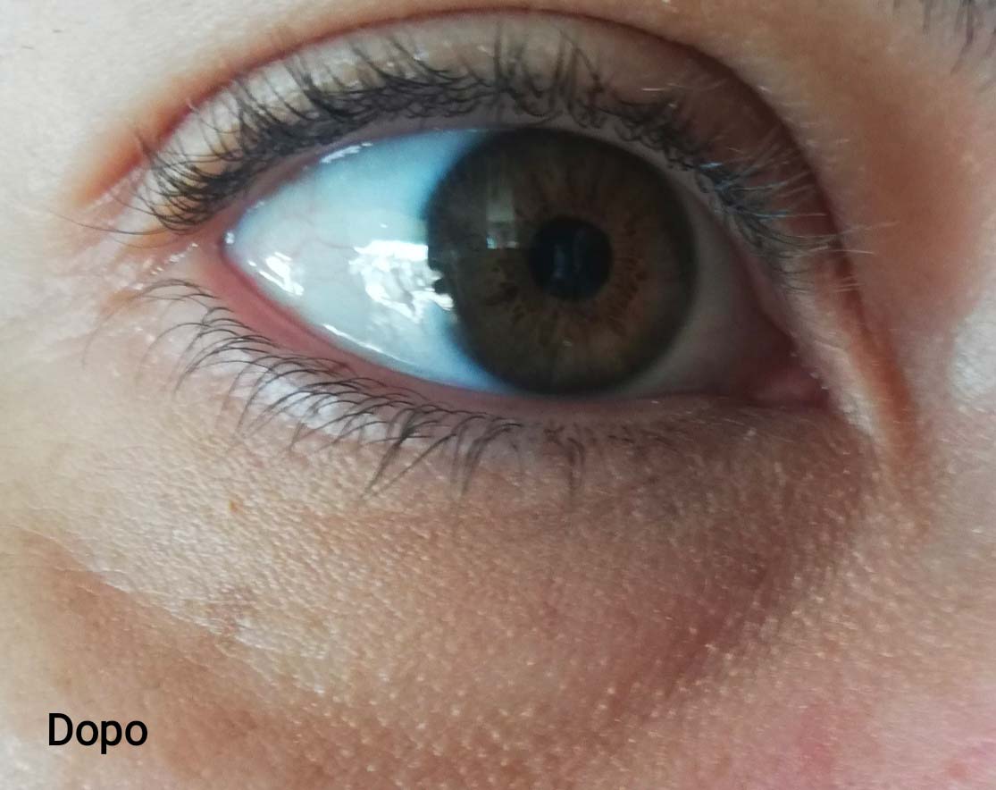 Dopo Correttore Wet N Wild Foto Focus Concealer