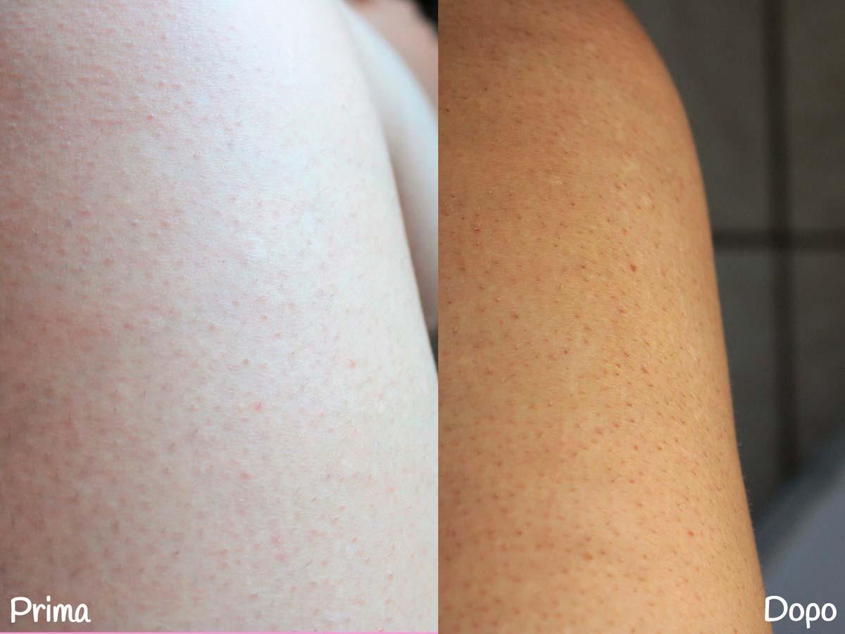 Prima e dopo mousse autoabbronzante coco and eve