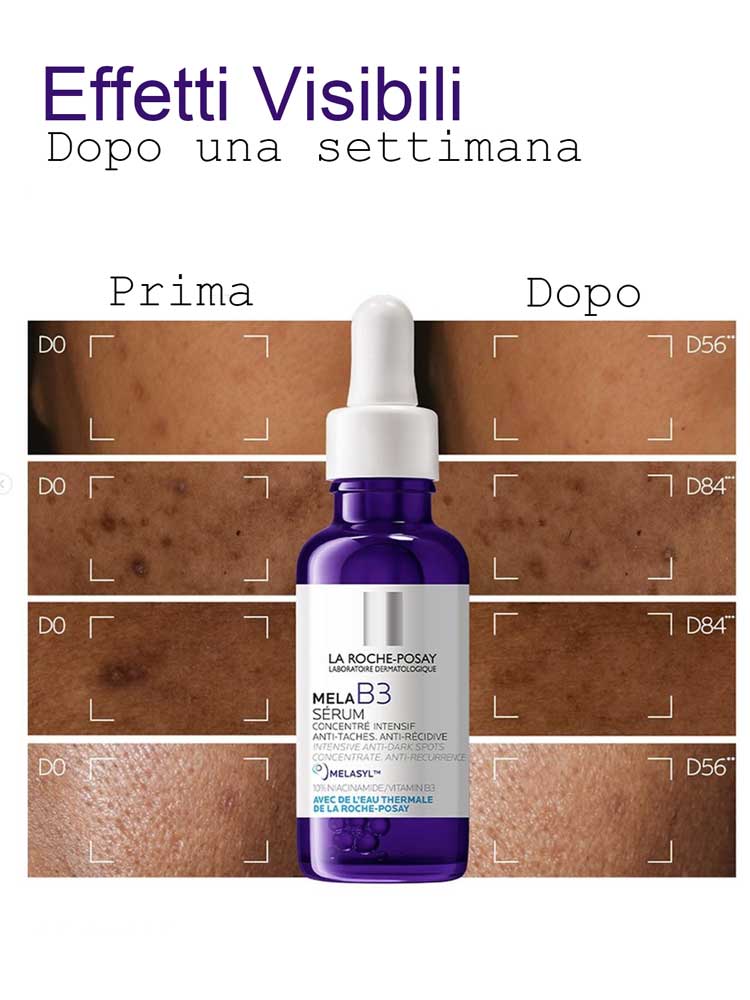 La Roche Posay siero MELA B3 prima dopo